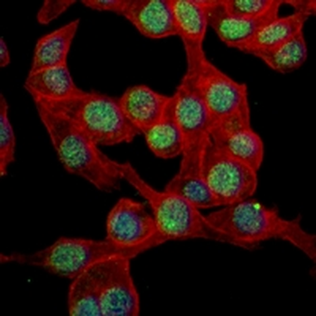 Cyclin E1 Rabbit Monoclonal Antibody