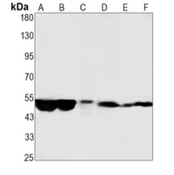 IgG1 Rabbit Monoclonal Antibody
