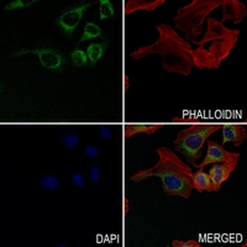 IgG1 Rabbit Monoclonal Antibody