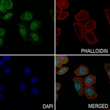 HSF1 Rabbit Monoclonal Antibody