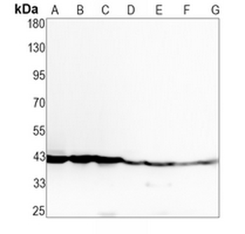 CD185 Rabbit Monoclonal Antibody
