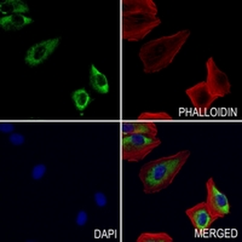 CD185 Rabbit Monoclonal Antibody