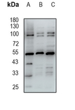 FKBP5 Rabbit Monoclonal Antibody