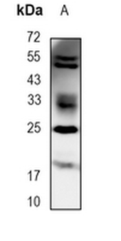 Stanniocalcin 1 Rabbit Monoclonal Antibody