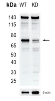 SENP1 Rabbit Monoclonal Antibody