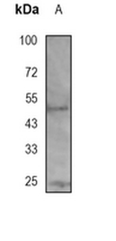 HTRA1 Rabbit Monoclonal Antibody