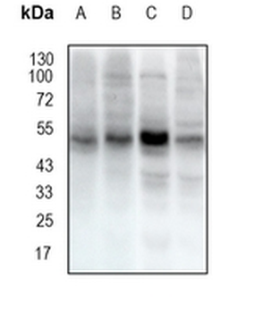 ST13 Rabbit Monoclonal Antibody