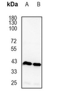 CECR5 Rabbit Monoclonal Antibody
