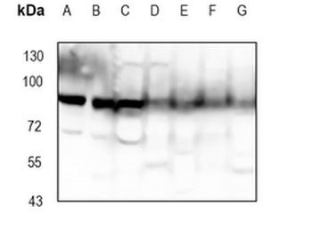 CD110 Rabbit Monoclonal Antibody