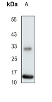 FABP1 Rabbit Monoclonal Antibody
