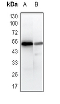 Gc-globulin Rabbit Monoclonal Antibody