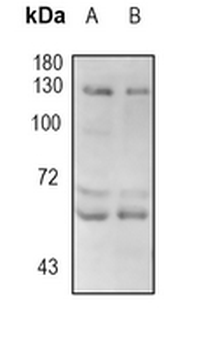 ABL2 Rabbit Monoclonal Antibody