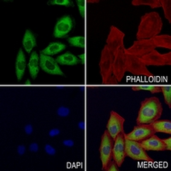 ABL2 Rabbit Monoclonal Antibody