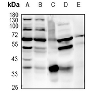 c-FOS Rabbit Monoclonal Antibody