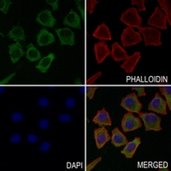 MKK2 Rabbit Monoclonal Antibody