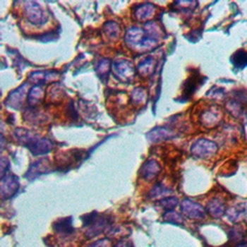 BMP4 Rabbit Monoclonal Antibody