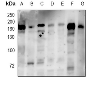 PDGFR beta Rabbit Monoclonal Antibody