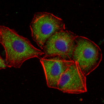 PDGFR beta Rabbit Monoclonal Antibody