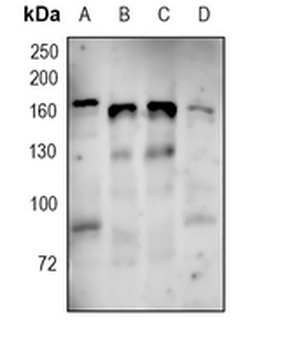 MSH6 Rabbit Monoclonal Antibody