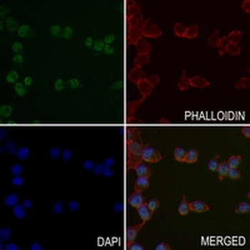 MSH6 Rabbit Monoclonal Antibody