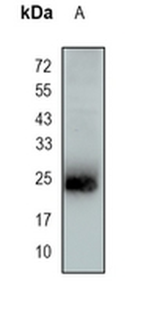 DNAJC12 Rabbit Monoclonal Antibody