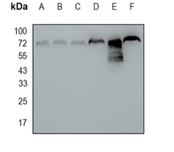 CTPS Rabbit Monoclonal Antibody