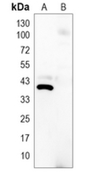 His-tag Mouse Monoclonal Antibody