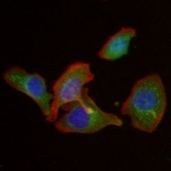 Myc-tag Mouse Monoclonal Antibody