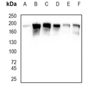 HER2 Rabbit Monoclonal Antibody