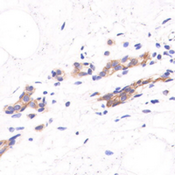 HER2 Rabbit Monoclonal Antibody