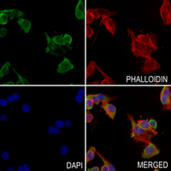 HER2 Rabbit Monoclonal Antibody