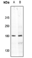 IRS1 Rabbit Polyclonal Antibody