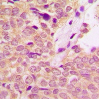 IRS1 Rabbit Polyclonal Antibody