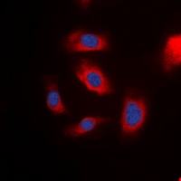 IRS1 Rabbit Polyclonal Antibody