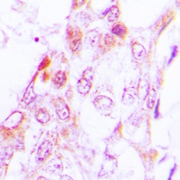 JAK3 Rabbit Polyclonal Antibody