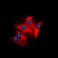 JAK3 Rabbit Polyclonal Antibody