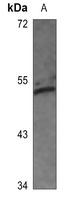 c-Jun (Phospho-S63) Rabbit Polyclonal Antibody