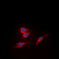 VEGFR2 (Phospho-Y951) Rabbit Polyclonal Antibody