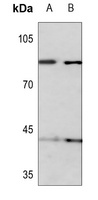 KIF2C (Phospho-S95) Rabbit Polyclonal Antibody
