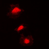 KIF2C (Phospho-S95) Rabbit Polyclonal Antibody
