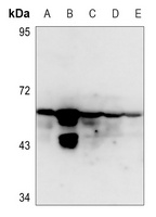 Cytokeratin 8 (Phospho-S432) Rabbit Polyclonal Antibody