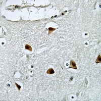 Galectin 7 Rabbit Polyclonal Antibody