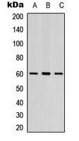 LYN (Phospho-Y397) Antibody