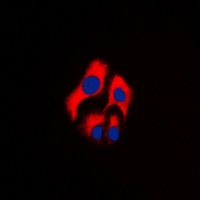 LYN (Phospho-Y397) Rabbit Polyclonal Antibody