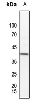 MKK3 (Phospho-T222) Rabbit Polyclonal Antibody