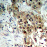 MKK4 Rabbit Polyclonal Antibody