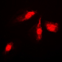 MKK4 Rabbit Polyclonal Antibody