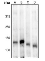 ASK1 (Phospho-S83) Antibody