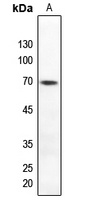 TAK1 (Phospho-T184) Antibody