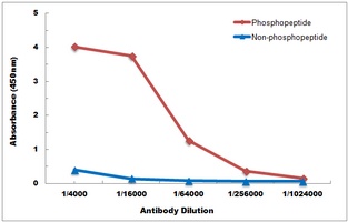 TAK1 (Phospho-T184) Antibody